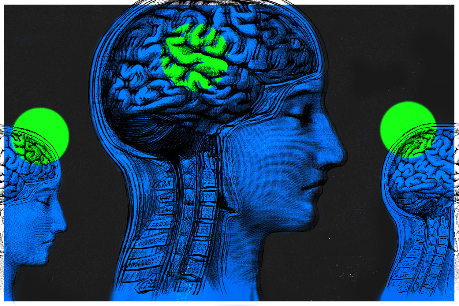 Graphic of a woman's brain from the side