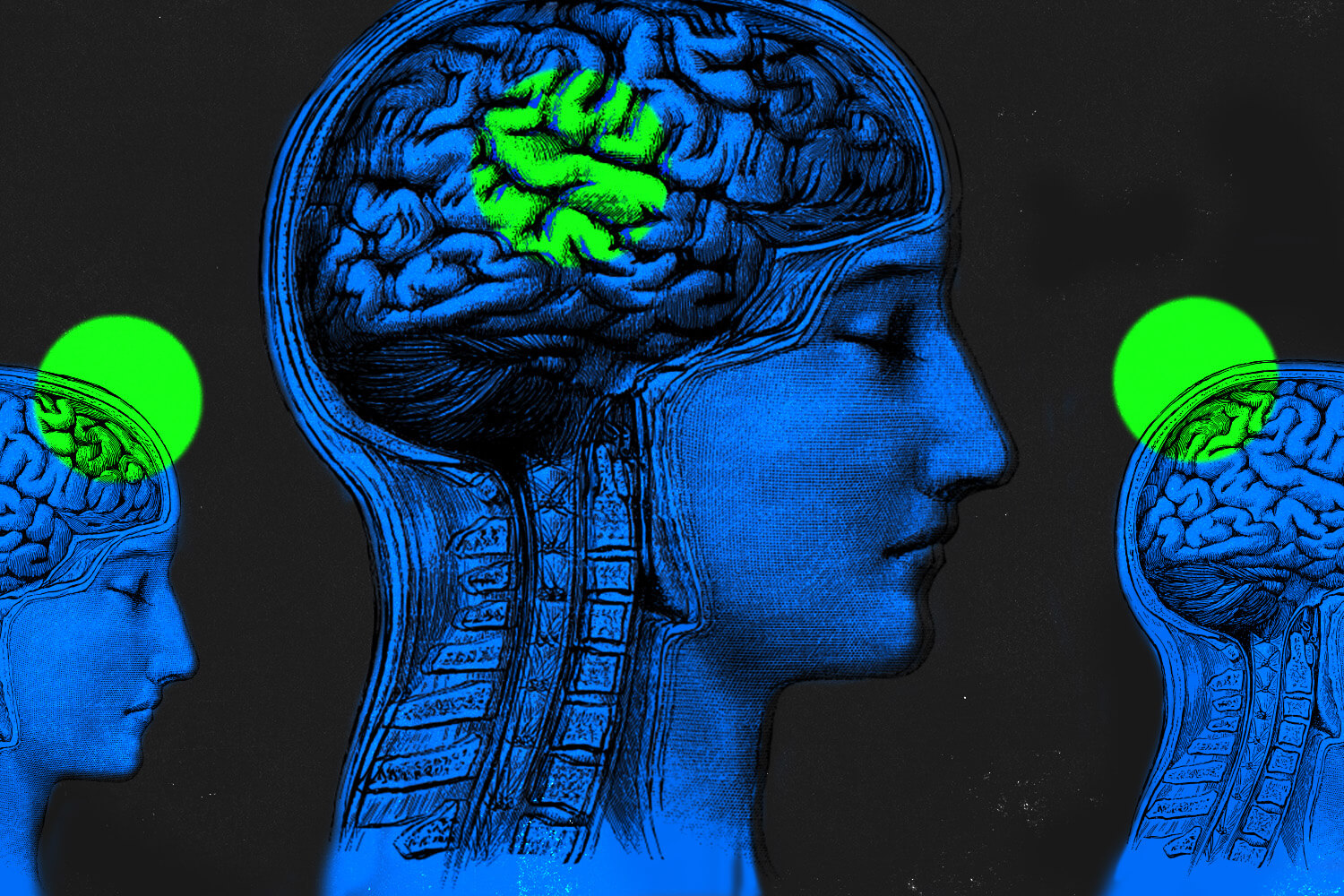 Graphic of a woman's brain from the side